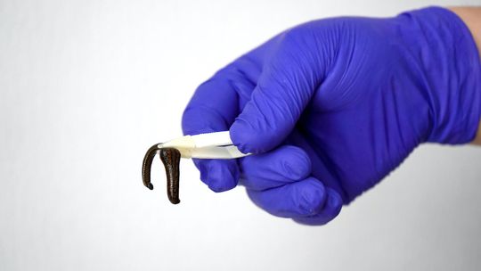 Hirudoterapia a cukrzyca – czy pijawki mogą wspierać leczenie tej choroby?