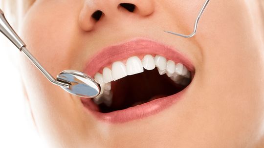 Jak działa bonding zębów? Wyjaśniamy procedurę i korzyści dla pacjentów