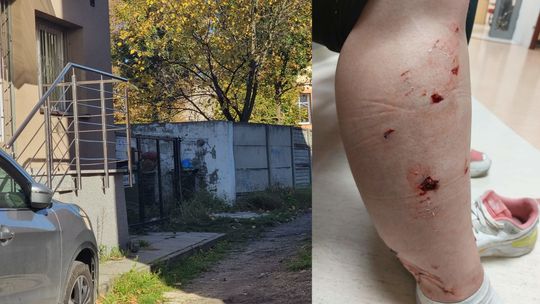 Kobieta została zaatakowana i pogryziona przez trzy psy