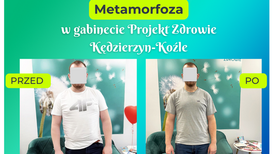 Kolejna świetna metamorfoza w gabinecie Projekt Zdrowie Kędzierzyn-Koźle -16 kg!