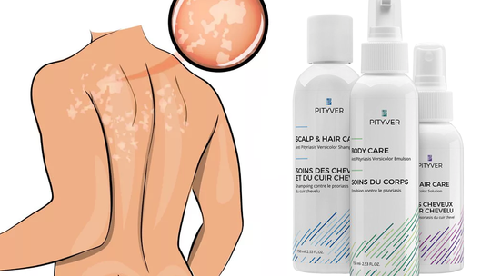 Kosmetyki na łupież pstry – niezawodne! Poznaj skuteczny zestaw dermokosmetyków Pityver!