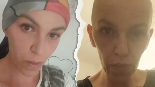 „Moje dzieci mnie potrzebują”. 39-letnia Basia z Kędzierzyna-Koźla walczy z rakiem. Pomóżmy jej!