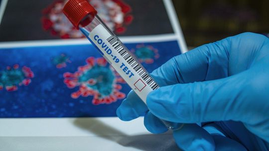 Osiem nowych przypadków zakażenia koronawirusem w regionie