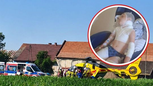 Prokuratura wszczęła śledztwo po dramatycznym pogryzieniu 9-latka przez psy w Maciowakrzu
