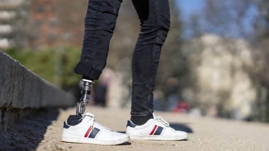 Protezy podudzia – sposób na odzyskanie samodzielności po amputacji podudzia