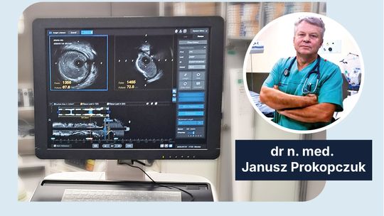 W Kędzierzynie-Koźlu przeprowadzono pierwsze zabiegi kardiologiczne z wykorzystaniem AI