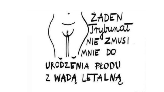 W Kędzierzynie-Koźlu też będzie protest przeciwko decyzji TK ws. aborcji. Ludzie wyjdą na ulice 3 listopada