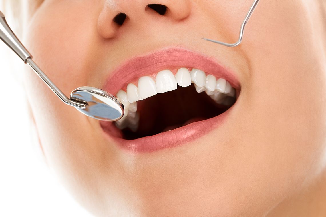 Jak działa bonding zębów? Wyjaśniamy procedurę i korzyści dla pacjentów