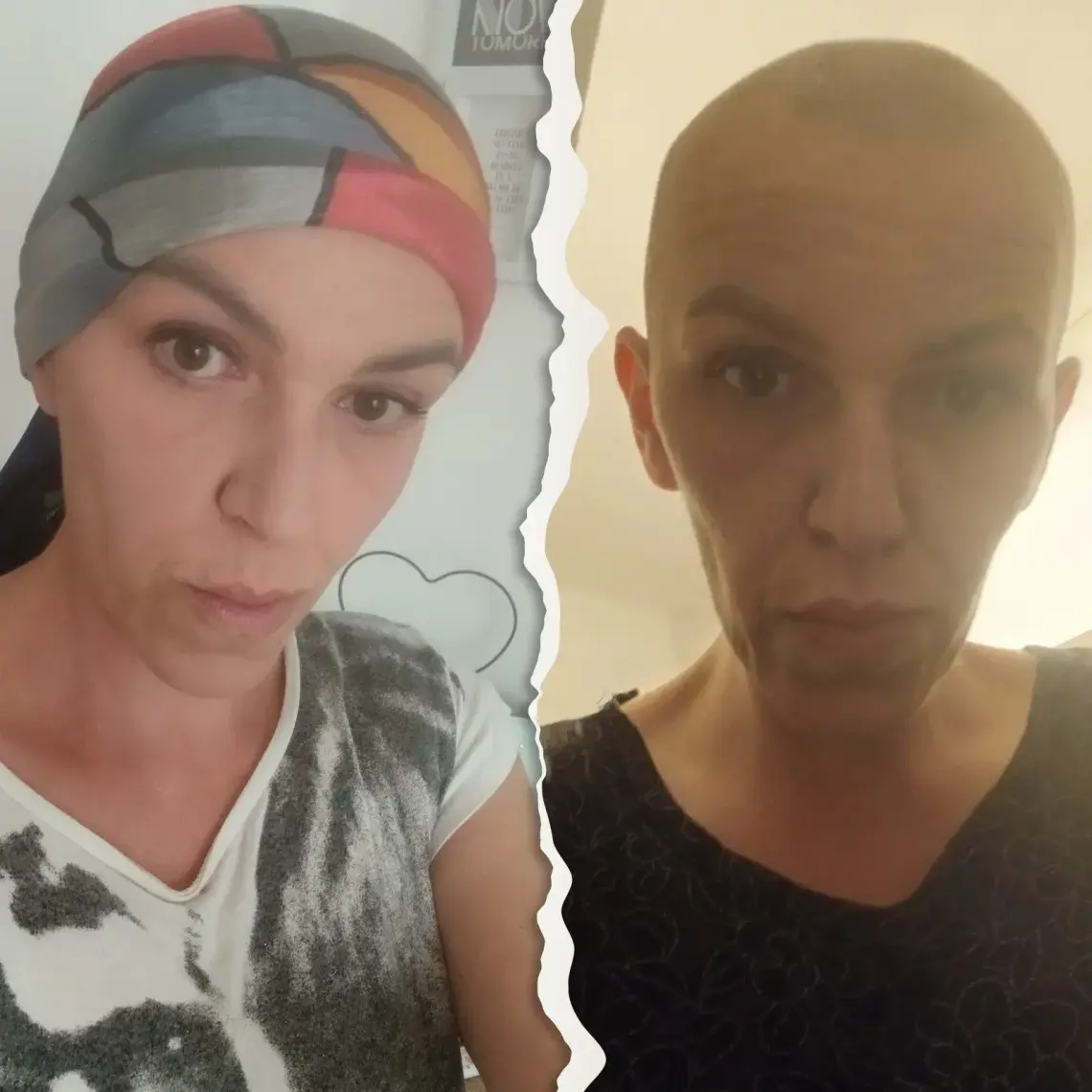 „Moje dzieci mnie potrzebują”. 39-letnia Basia z Kędzierzyna-Koźla walczy z rakiem. Pomóżmy jej! „Moje dzieci mnie potrzebują”. 39-letnia Basia z Kędzierzyna-Koźla walczy z rakiem. Pomóżmy jej!