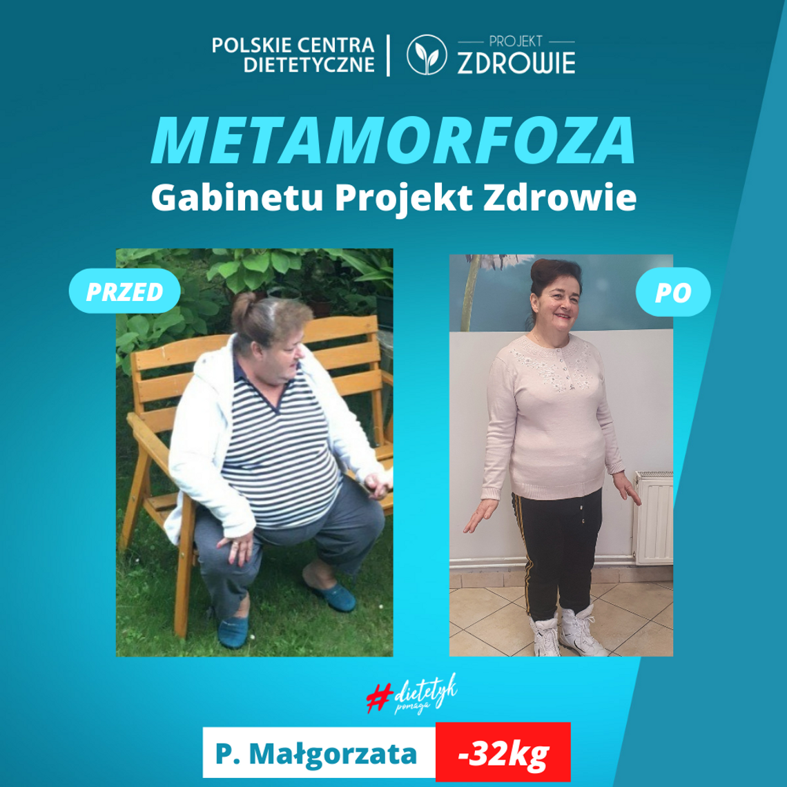 Niesamowita metamorfoza w Projekt Zdrowie. Pani Małgosia schudła 32 kg