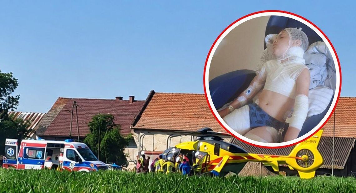 Prokuratura wszczęła śledztwo po dramatycznym pogryzieniu 9-latka przez psy w Maciowakrzu Prokuratura wszczęła śledztwo po dramatycznym pogryzieniu 9-latka przez psy w Maciowakrzu