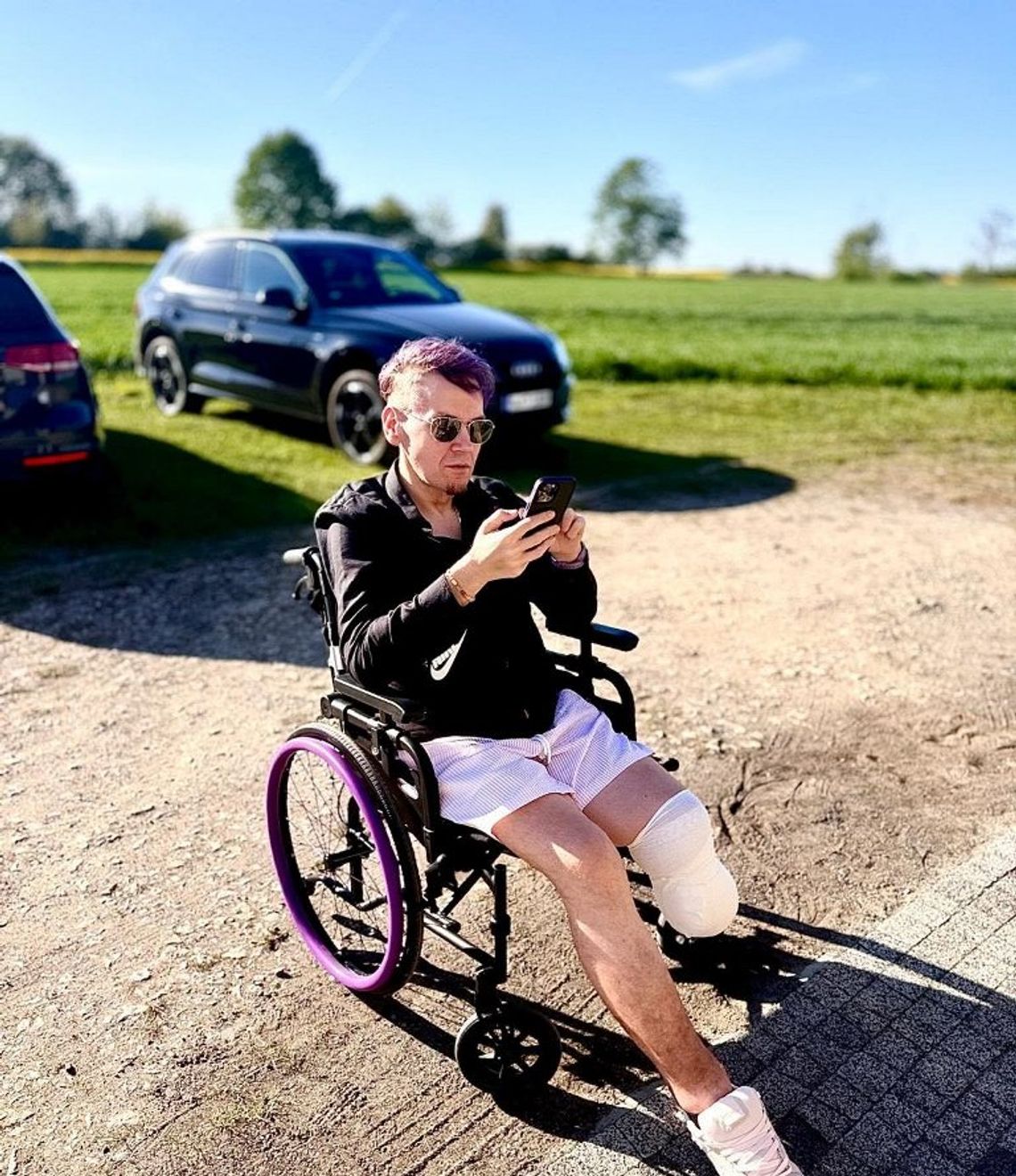 Stracił nogę, ale nie nadzieję. Ludzie ruszyli z pomocą Stracił nogę, ale nie nadzieję. Ludzie ruszyli z pomocą