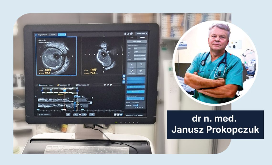 W Kędzierzynie-Koźlu przeprowadzono pierwsze zabiegi kardiologiczne z wykorzystaniem AI